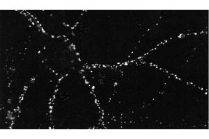 ICC of PSD95 in cultures of dissociated hippocampal neurons. (DLG4 antibody  (PE))