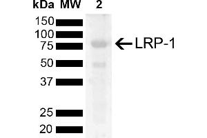 Western blot analysis of Rat Kidney showing detection of 504. (LRP1 antibody  (AA 2880-2980) (FITC))
