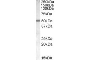 Image no. 1 for anti-Cholinergic Receptor, Nicotinic, beta 3 (Neuronal) (CHRNB3) (Internal Region) antibody (ABIN374999)