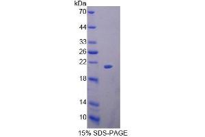 SDS-PAGE (SDS) image for Heparanase (HPSE) (AA 40-188) protein (His tag) (ABIN3209882) (HPSE Protein (AA 40-188) (His tag))