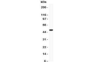 Western blot testing of MCAK antibody and recombinant human protein (0. (KIF2C antibody  (AA 531-725))