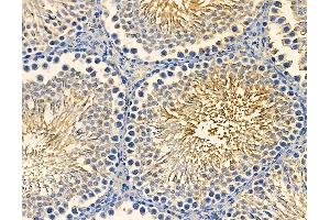 ABIN7094986 and ABIN7099042 at 1/100 staining rat testis tissue by IHC-P. (ARHGAP44 antibody)