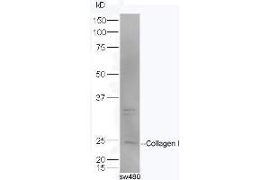 SW480 lysates probed with Rabbit Anti-Pro-Collagen I Polyclonal Antibody, Unconjugated  at 1:5000 for 90 min at 37˚C. (Collagen Type I antibody  (AA 1321-1400))