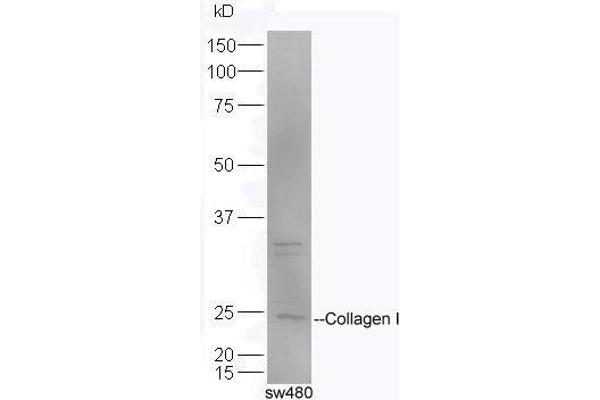 Collagen Type I Antikörper  (AA 1321-1400)