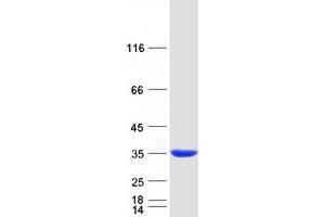 Validation with Western Blot (PBLD1 Protein (Transcript Variant 1) (Myc-DYKDDDDK Tag))