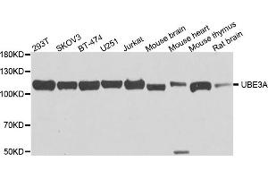 Western blot analysis of extract of various cells, using UBE3A antibody.