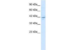 WB Suggested Anti-ZNF237 Antibody Titration:  1. (ZMYM5 antibody  (N-Term))