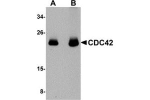 Western Blotting (WB) image for anti-Cell Division Cycle 42 (GTP Binding Protein, 25kDa) (CDC42) (N-Term) antibody (ABIN1031310) (CDC42 antibody  (N-Term))