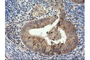 Image no. 6 for anti-HRas proto-oncogene, GTPase (HRAS) antibody (ABIN1498714) (HRAS antibody)