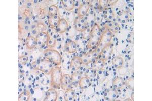 Used in DAB staining on fromalin fixed paraffin- embedded Kidney tissue (SRPRB antibody  (AA 56-269))