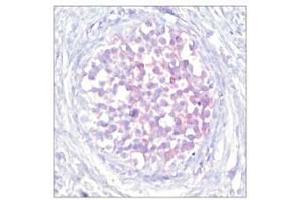 Image no. 1 for anti-V-Raf-1 Murine Leukemia Viral Oncogene Homolog 1 (RAF1) (pSer259) antibody (ABIN196619) (RAF1 antibody  (pSer259))