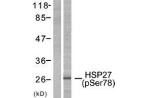 Western blot analysis of extracts from HeLa cells treated with Ca2+, using HSP27 (Phospho-Ser78) Antibody. (HSP27 antibody  (pSer78))