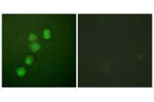 Immunofluorescence analysis of HuvEc cells, using Cyclin E1 (Ab-395) antibody. (Cyclin E1 antibody  (Thr395))