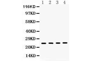 Western blot analysis of HMGB1 expression in rat brain extract ( Lane 1), mouse ovary extract ( Lane 2), 22RV1 whole cell lysates ( Lane 3) and HELA whole cell lysates ( Lane 4). (HMGB1 antibody  (C-Term))