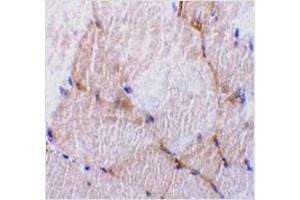 Immunohistochemistry of caspase-7 in rat skeletal muscle tissue with caspase-7 antibody at 10 μg/ml. (Caspase 7 antibody  (N-Term))