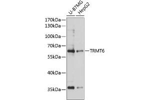 Western blot analysis of extracts of various cell lines, using TRMT6 antibody (ABIN6133079, ABIN6149556, ABIN6149557 and ABIN6224931) at 1:3000 dilution.