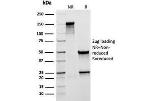 SDS-PAGE Analysis Purified MUC5AC Recombinant Mouse Monoclonal Antibody (rMUC5AC/3779). (Recombinant MUC5AC antibody)