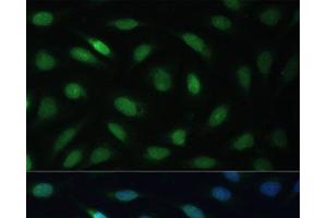 Immunofluorescence analysis of U-2 OS cells using LBR Polyclonal Antibody at dilution of 1:100 (40x lens).