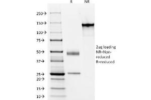 SDS-PAGE Analysis Purified Cytokeratin, LMW Monoclonal Antibody (AE-1). (Keratin 77 antibody)