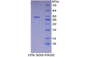 SDS-PAGE (SDS) image for Heme Oxygenase (Decycling) 2 (HMOX2) (AA 71-306) protein (His tag) (ABIN2125163)