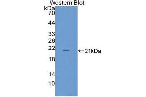 Western Blotting (WB) image for anti-Regenerating Islet-Derived 1 beta (REG1B) (AA 23-166) antibody (ABIN1870282)