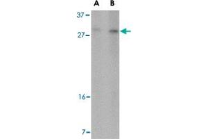 Western blot analysis of DDIT4 in 293 cell lysate with DDIT4 polyclonal antibody  at (A) 2 and (B) 4 ug/mL . (DDIT4 antibody  (Internal Region))