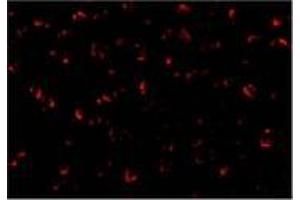 Immunofluorescence of ASK1 in A431 cells with AP30085PU-N ASK1 antibody at 20 μg/ml. (ASK1 antibody  (C-Term))