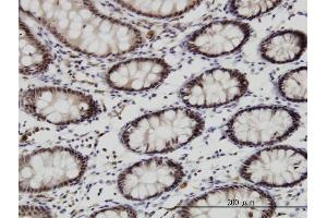 Immunoperoxidase of monoclonal antibody to GSC on formalin-fixed paraffin-embedded human colon. (GSC antibody  (AA 151-257))