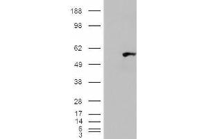 HEK293 overexpressing WIPF1 (ABIN5409971) and probed with ABIN334525 (mock transfection in first lane). (WIPF1 antibody  (C-Term))