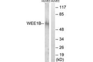Western Blotting (WB) image for anti-WEE1 Homolog 2 (S. Pombe) (WEE2) (AA 151-200) antibody (ABIN2890693) (WEE2 antibody  (AA 151-200))