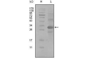 Western blot analysis using ALCAM mouse mAb against truncated Trx-ALCAM recombinant protein (1). (CD166 antibody  (AA 405-524))