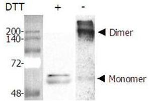 Dimer formation of recombinant Nampt (Visfatin, PBEF) . (NAMPT Protein (AA 1-491) (His tag))