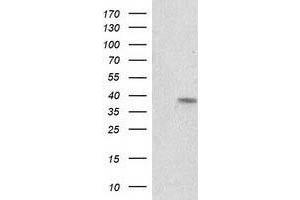Western Blotting (WB) image for anti-Retinol Dehydrogenase 14 (All-Trans/9-Cis/11-Cis) (RDH14) antibody (ABIN1500657) (RDH14 antibody)