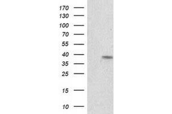 RDH14 antibody