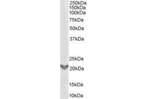 ABIN185466 (0. (TGIF2 antibody  (Internal Region))