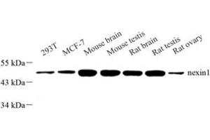 Western blot analysis of NEXIN1 (ABIN7075572) at dilution of 1: 500 (SERPINE2 antibody)