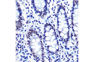 Immunohistochemistry of paraffin-embedded human colon using Phospho-SMC1-S957 Rabbit mAb (ABIN7270613) at dilution of 1:100 (40x lens). (SMC1A antibody  (pSer957))
