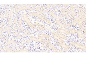 Detection of PDGF BB in Mouse Kidney Tissue using Polyclonal Antibody to Platelet Derived Growth Factor BB (PDGF BB) (PDGF-BB Homodimer (AA 21-241) antibody)