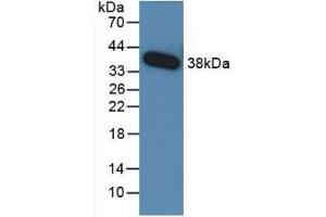 Detection of Recombinant TGFb3, Human using Monoclonal Antibody to Transforming Growth Factor Beta 3 (TGFb3) (TGFB3 antibody  (AA 24-300))