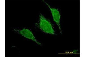 Immunofluorescence of purified MaxPab antibody to ACADM on HeLa cell. (Medium-Chain Specific Acyl-CoA Dehydrogenase, Mitochondrial (AA 1-421) antibody)