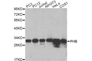 Western blot analysis of extracts of various cell lines, using PHB antibody. (Prohibitin antibody  (AA 73-272))