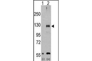 Western blot analysis of TR (arrow) using rabbit polyclonal TR Antibody (Center ) (ABIN392820 and ABIN2842252). (TRPM8 antibody  (AA 521-552))
