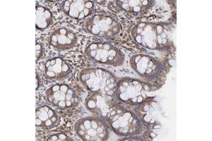 Immunohistochemical staining of human rectum with RNF213 polyclonal antibody  shows moderate cytoplasmic positivity in glandular cells at 1:200-1:500 dilution. (RNF213 antibody)