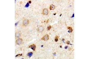 Immunohistochemical analysis of MYPT1 staining in human brain formalin fixed paraffin embedded tissue section. (PPP1R12A antibody)