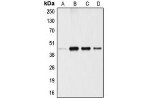 Western blot analysis of ANGPTL4 expression in A549 (A), 293T (B), U87MG (C), SGC (D) whole cell lysates.