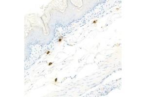 Immunohistochemistry analysis of paraffin-embedded mouseskinusing Chymase (ABIN7073506) at dilution of 1:1000