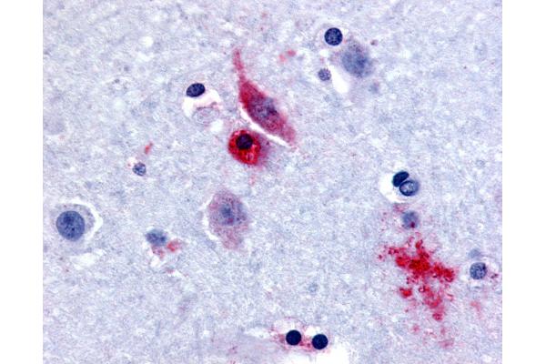 GPR61 antibody  (Extracellular Domain)