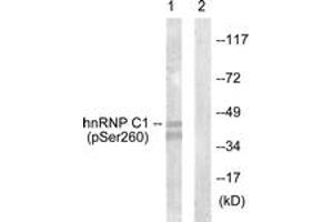 Western blot analysis of extracts from 293 cells treated with H2O2 100uM 15', using hnRNP C1/2 (Phospho-Ser260) Antibody. (HNRNPC antibody  (pSer260))