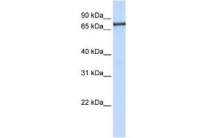 WB Suggested Anti-TNPO2 Antibody Titration: 0. (TNPO2 antibody  (C-Term))
