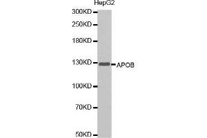 Western blot analysis of extracts of HepG2 cells lines, using APOB antibody. (APOB antibody  (AA 28-330))